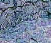 Skin cells